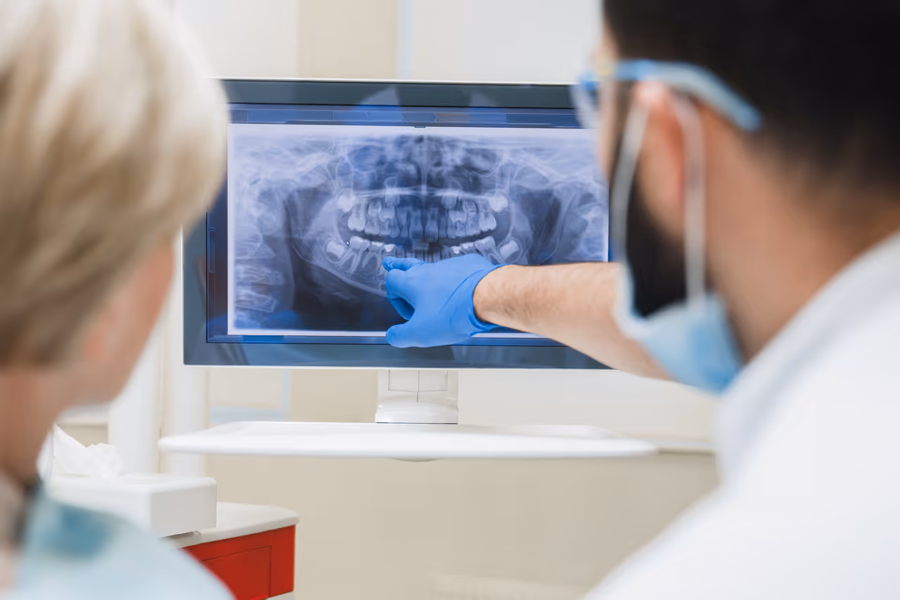 Root Canal Therapy: How It Saves Your Tooth and Relieves Pain?
