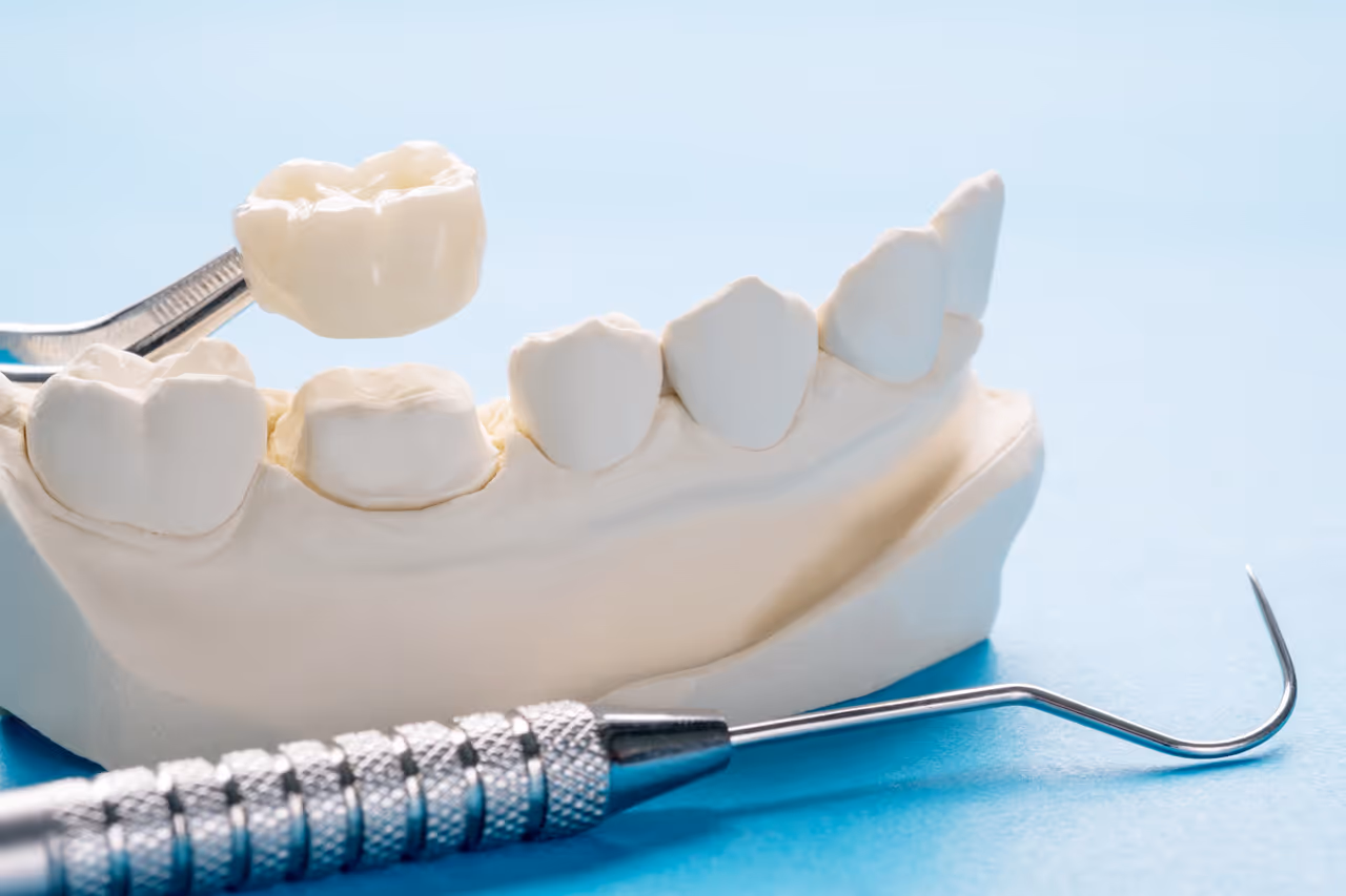 What to Expect After Getting a Same-Day Dental Crown