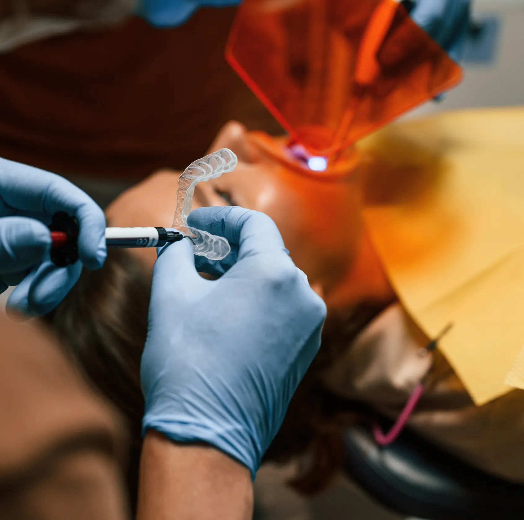 Dentist marking a clear dental tray, patient lies with orange protective glasses during teeth whitening.