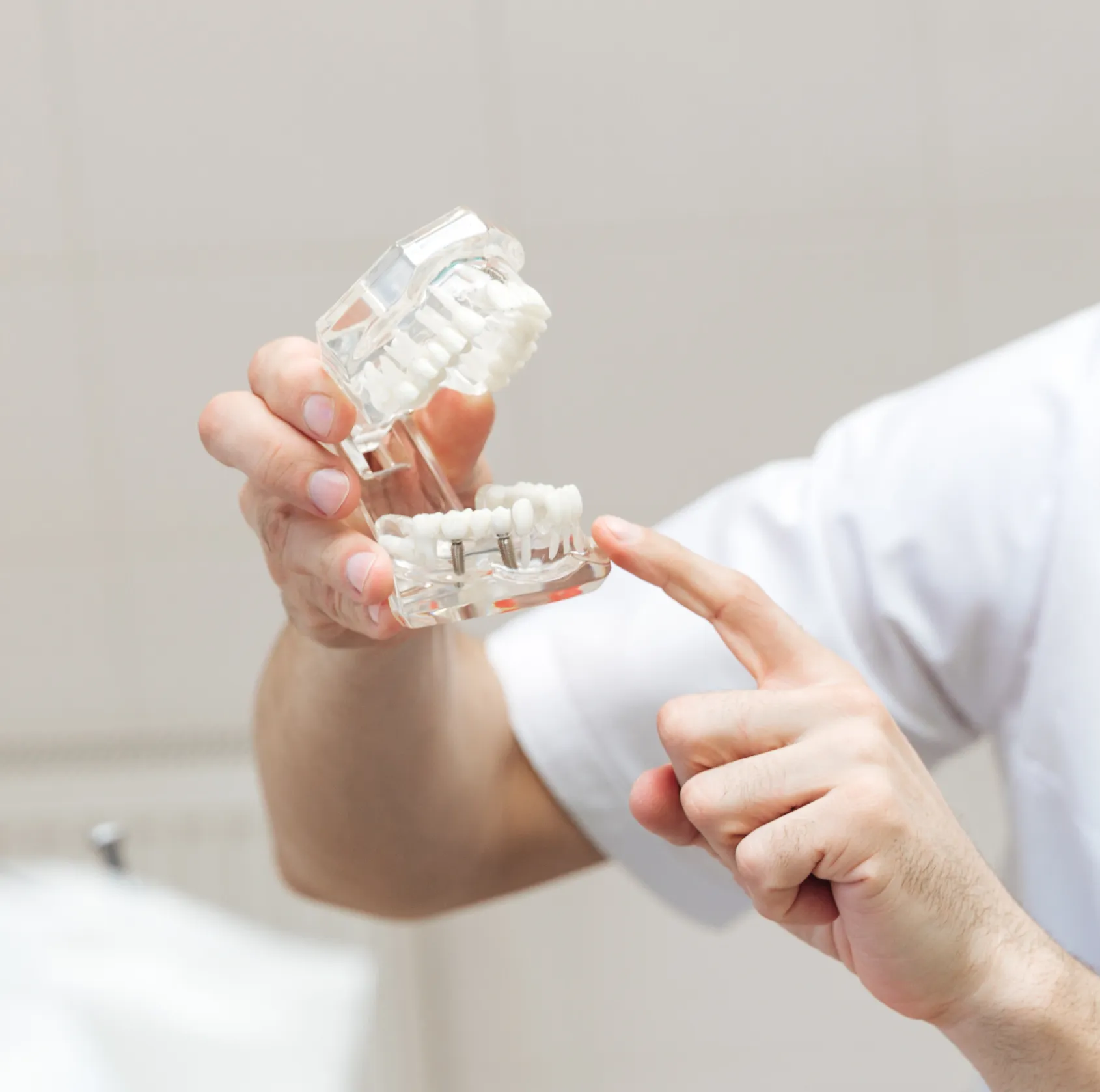 Person holding dental model showing implants on lower jaw with fingers pointing at them.