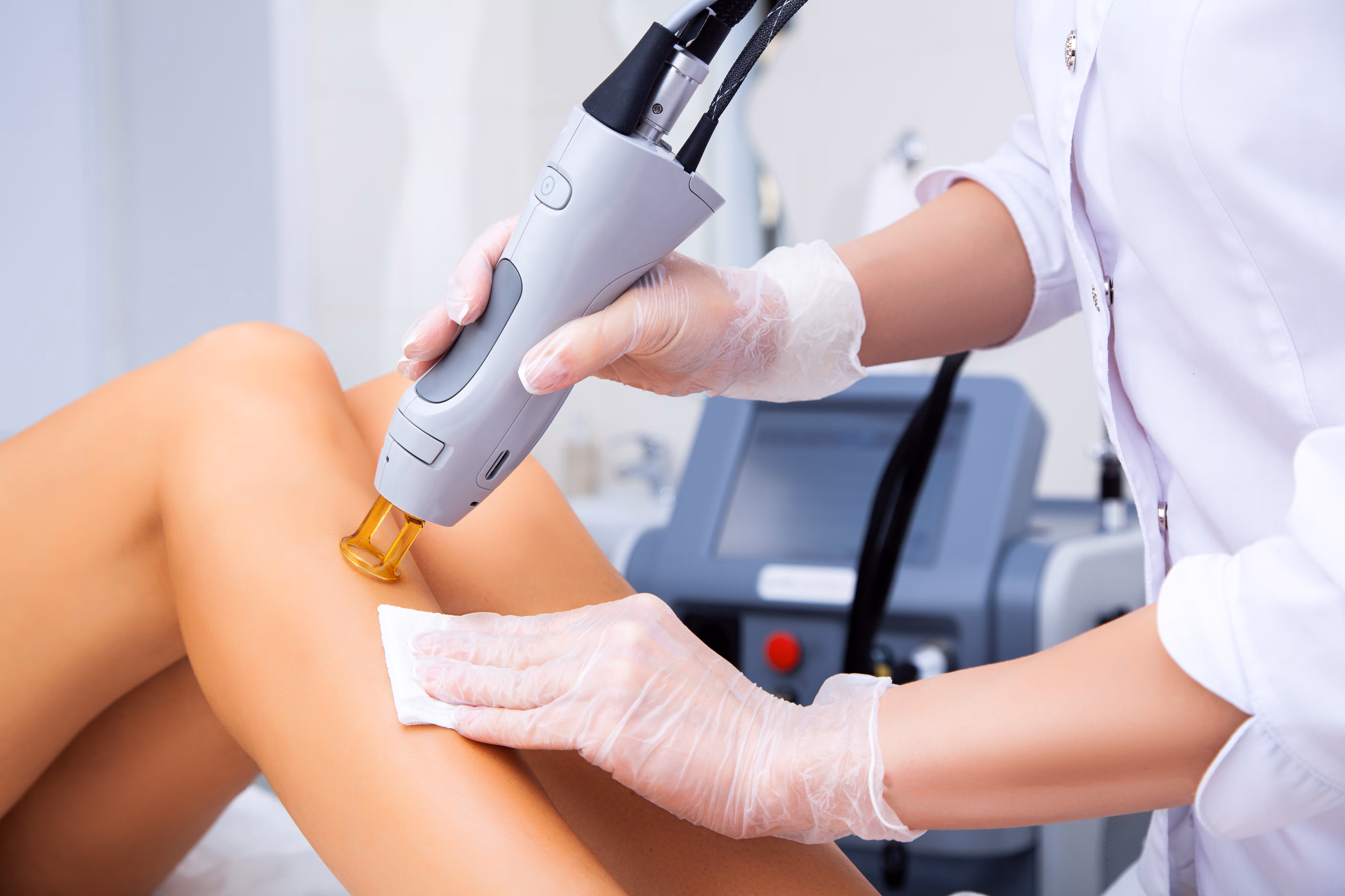 Professional wearing gloves performing laser hair removal treatment on a person's leg.