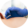 IMS & Dry Needling