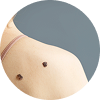 Epidermoid Cyst Removal