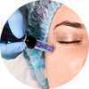 PRP - Microneedling