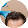 PRP – Hair Loss