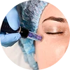 PRP - Microneedling