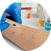 Keloid Scar Steroid Injection