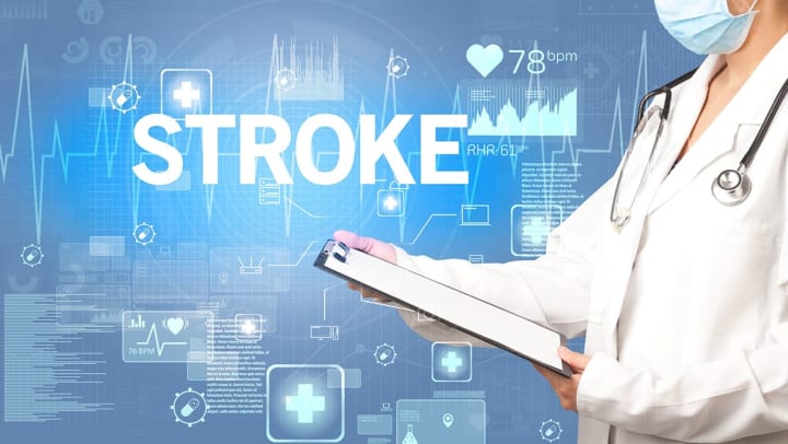 Can a Stroke Increase the Risk of Dementia?