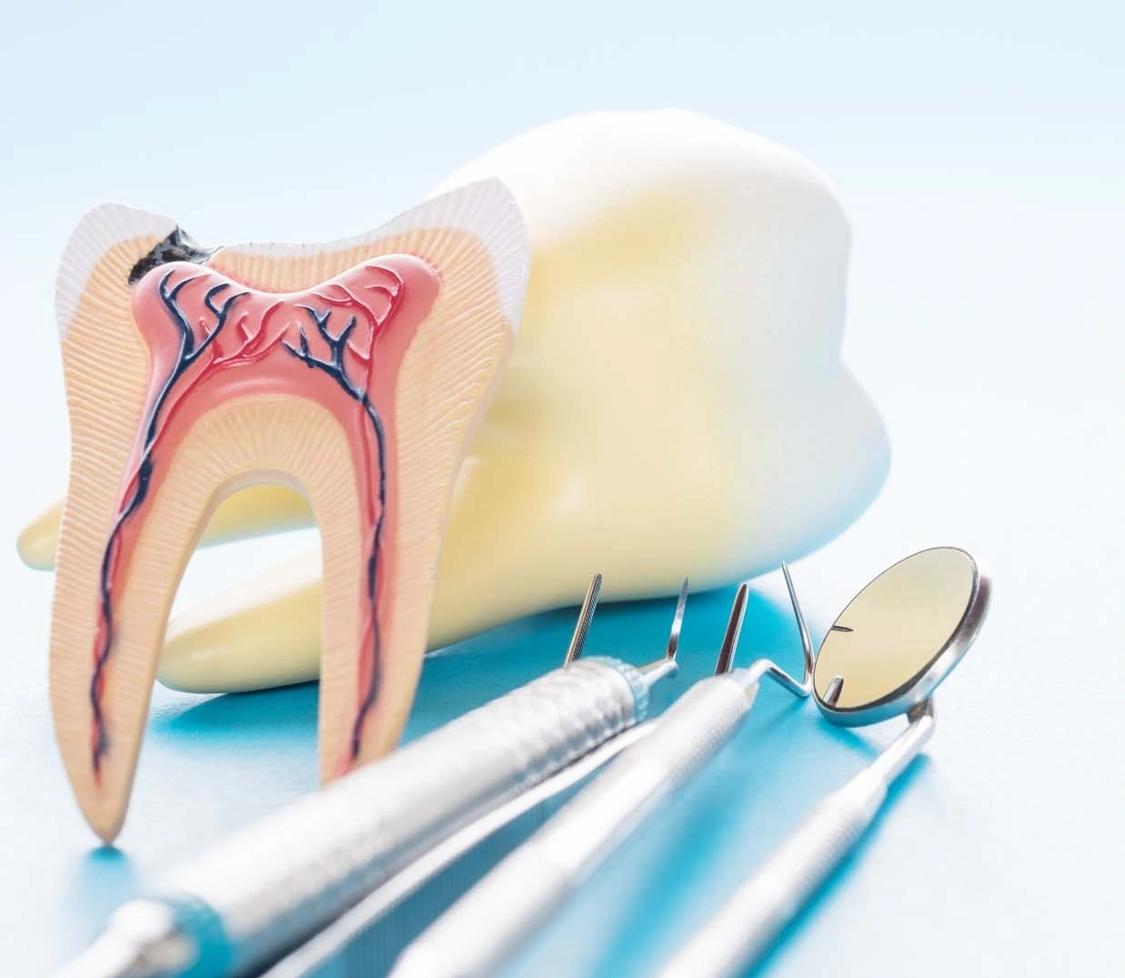 Advanced Endodontics: When a Root Canal Needs Post and Core Restoration