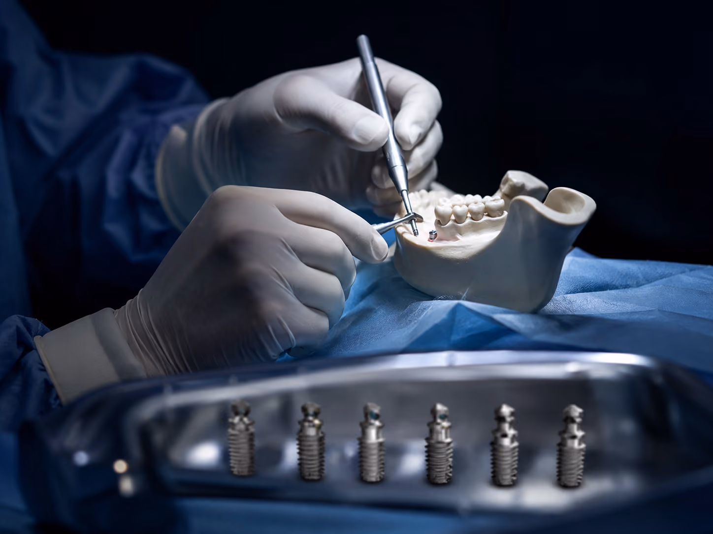 Oral surgeon placing dental implants during surgery