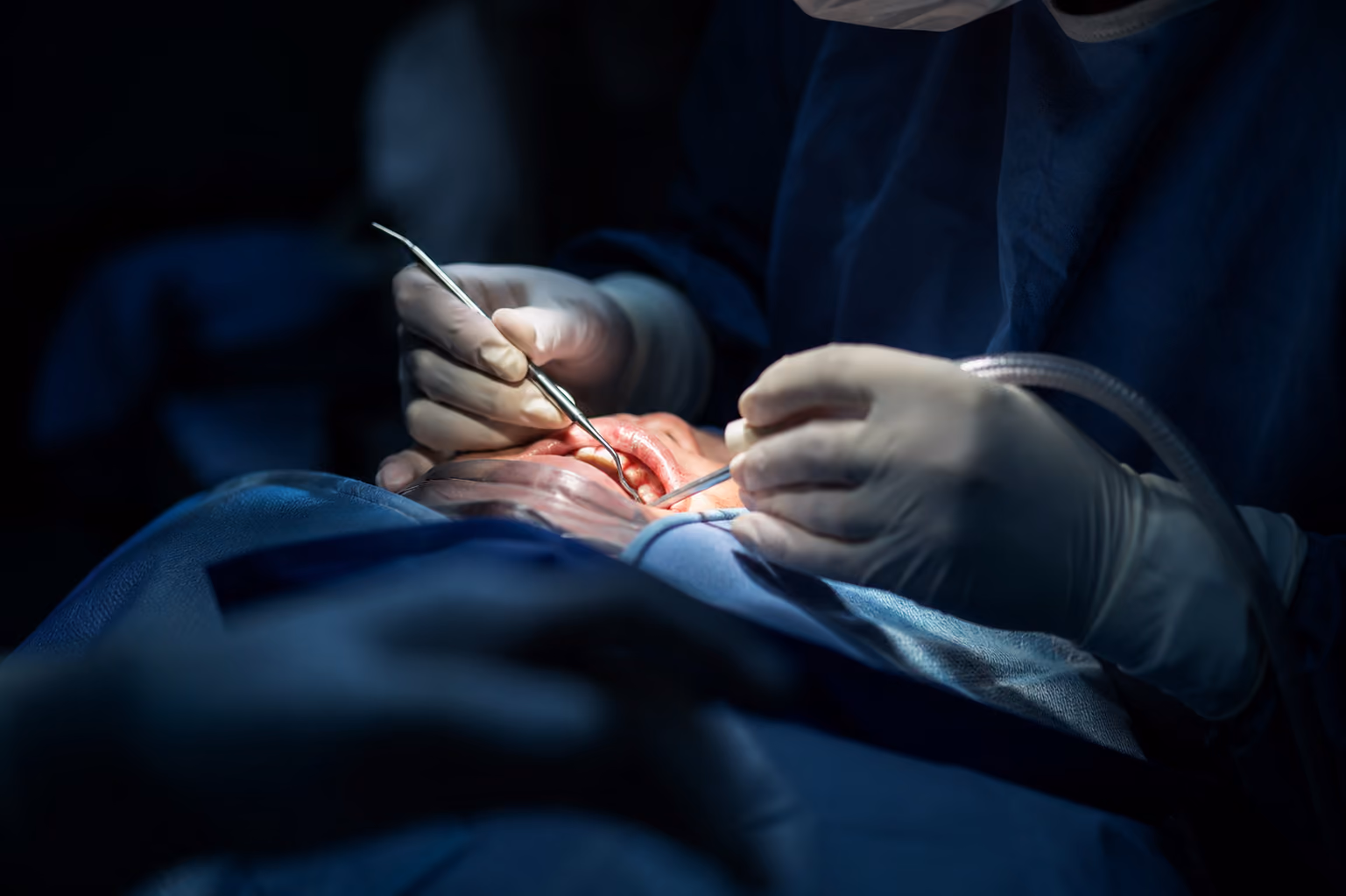 Board-certified oral surgeon placing dental implants under in-house IV sedation
