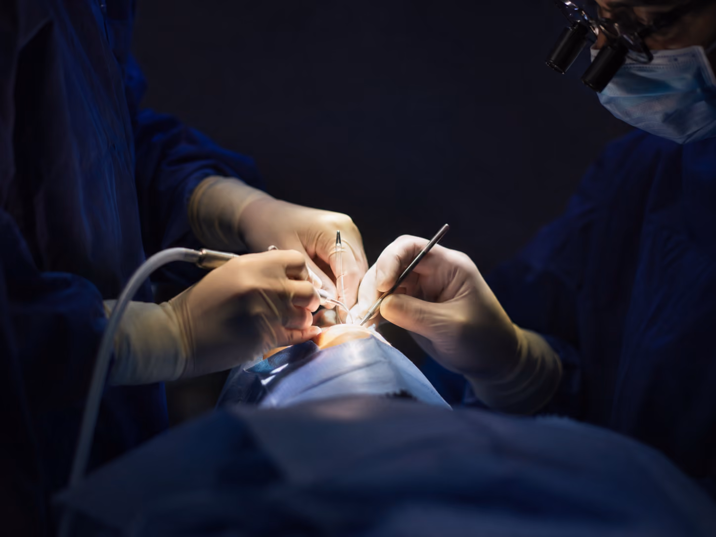 Board-certified oral surgeon placing dental implants under in-house IV sedation