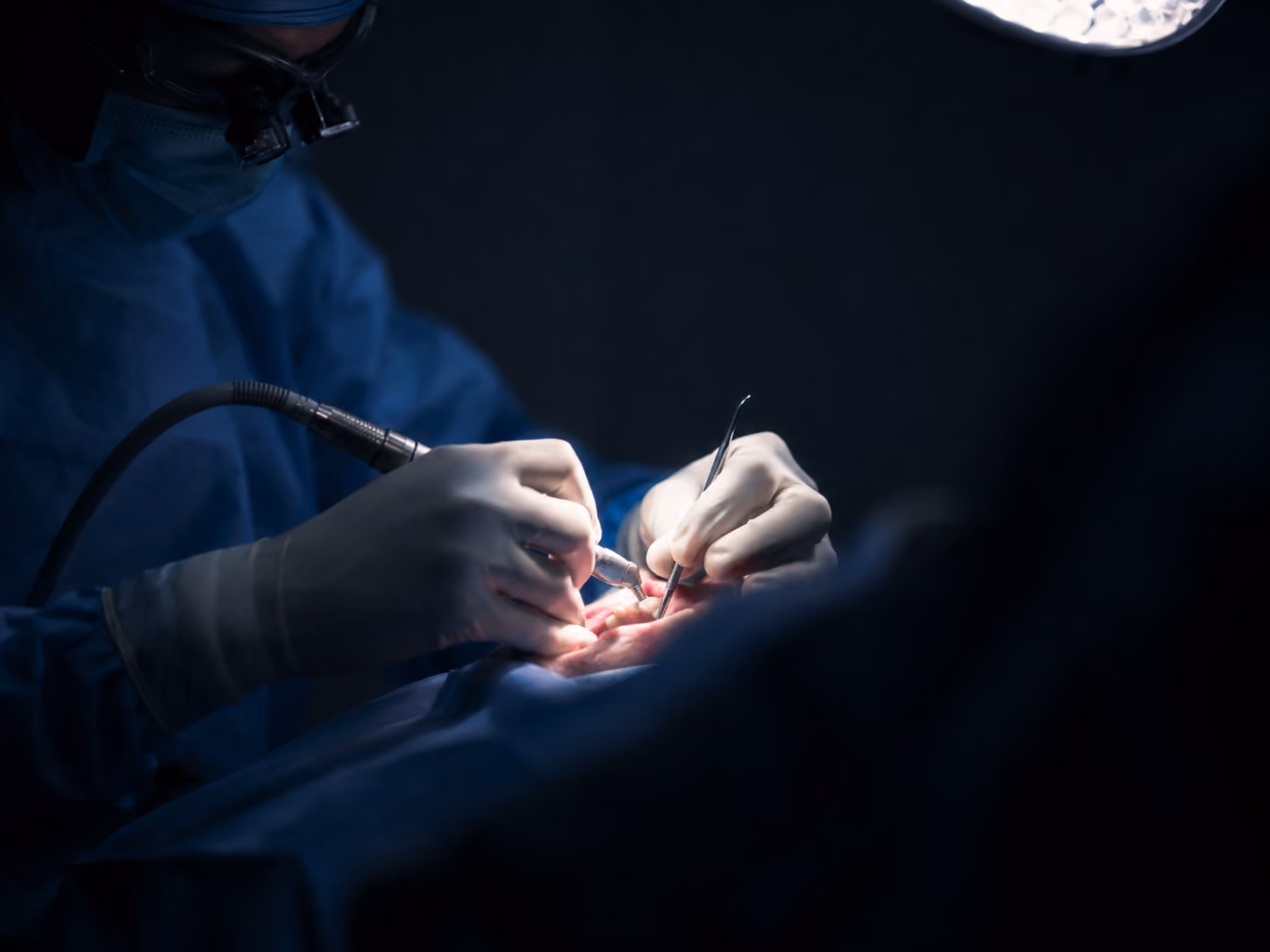 Board-certified oral surgeon placing dental implants under in-house IV sedation