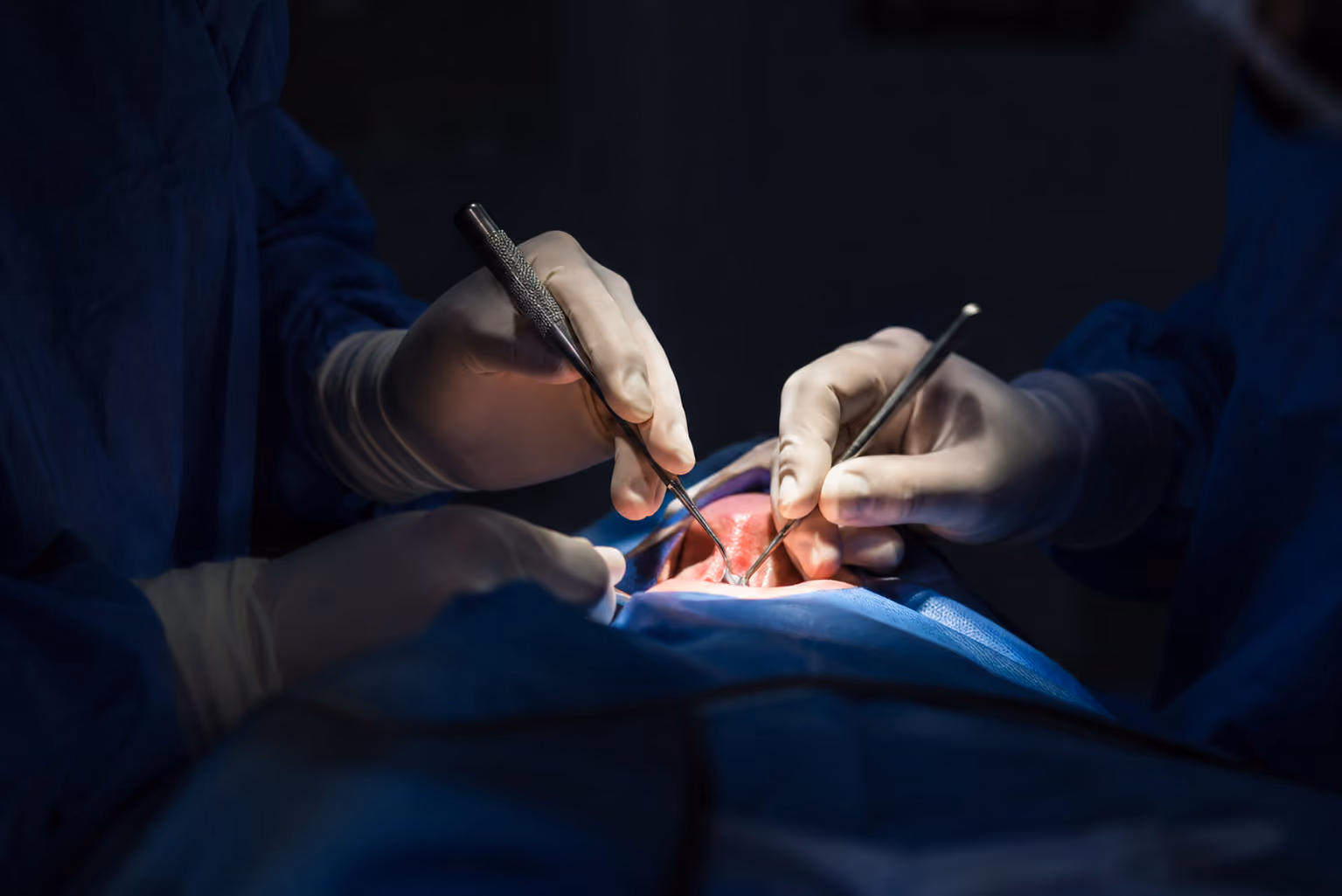 Oral surgeon placing dental implants under in-house IV sedation at Elite Oral Surgery in Bonney Lake, WA