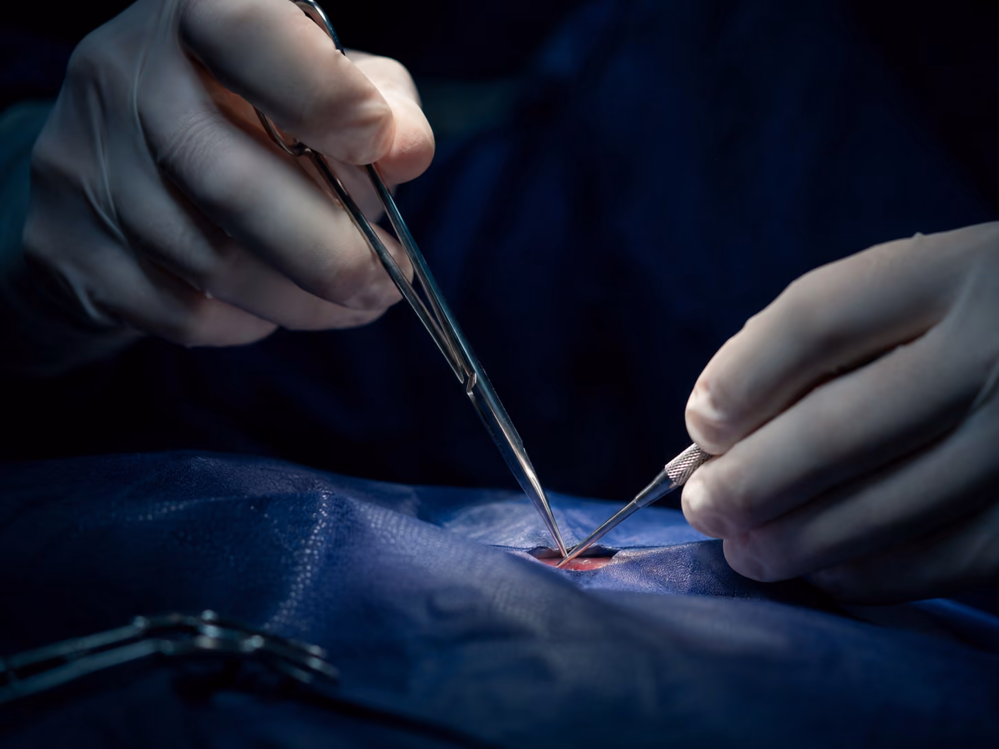 Oral surgeon placing dental implants under in-house IV sedation at Elite Oral Surgery