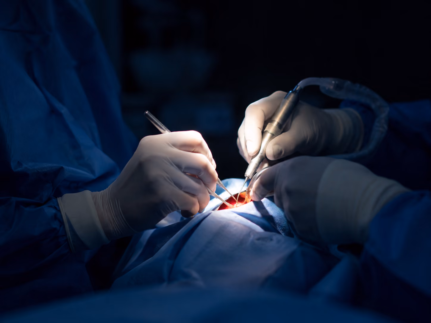 Board-certified oral surgeon placing dental implants under in-house IV sedation