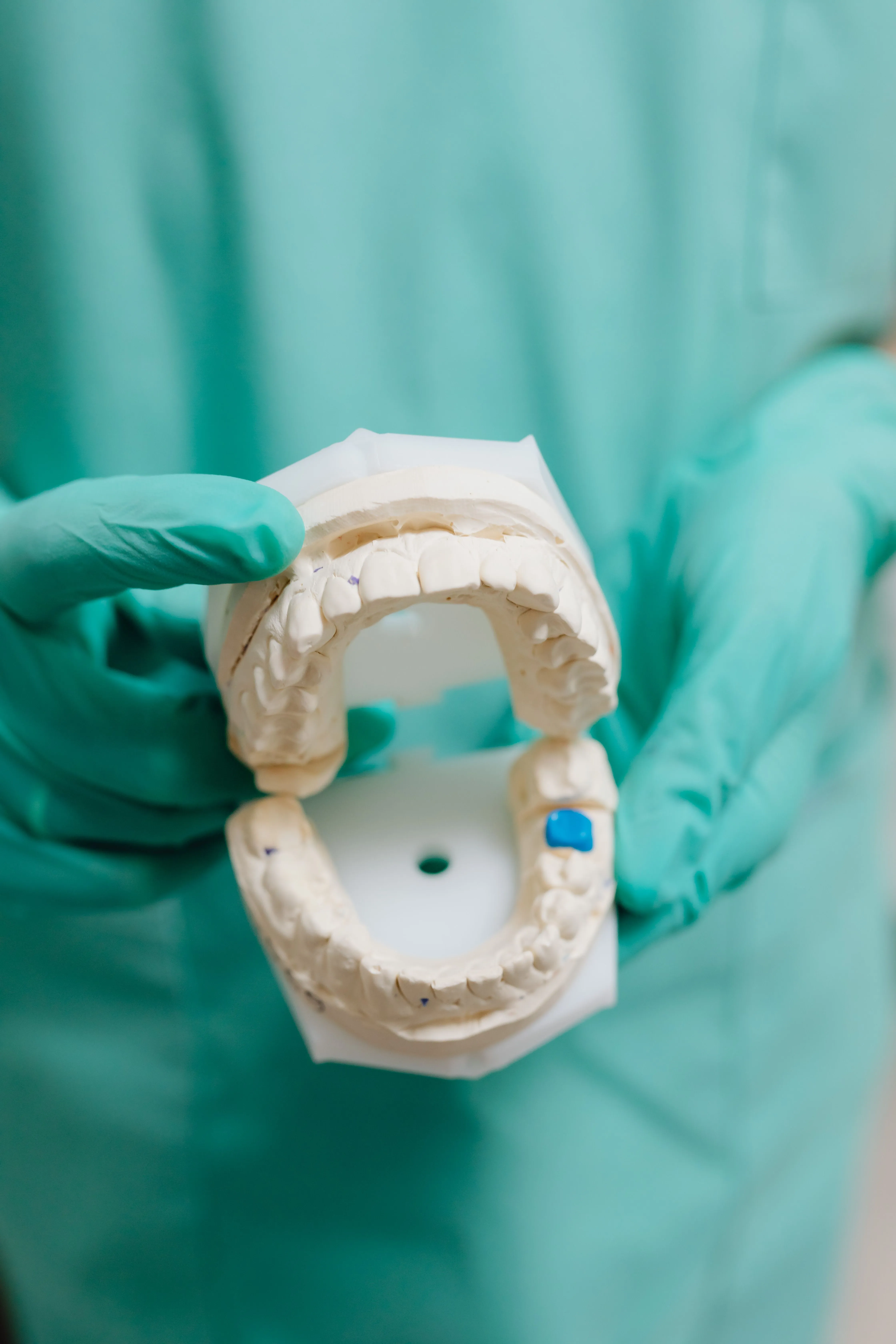 Cone beam CT scan used for digital implant surgical planning