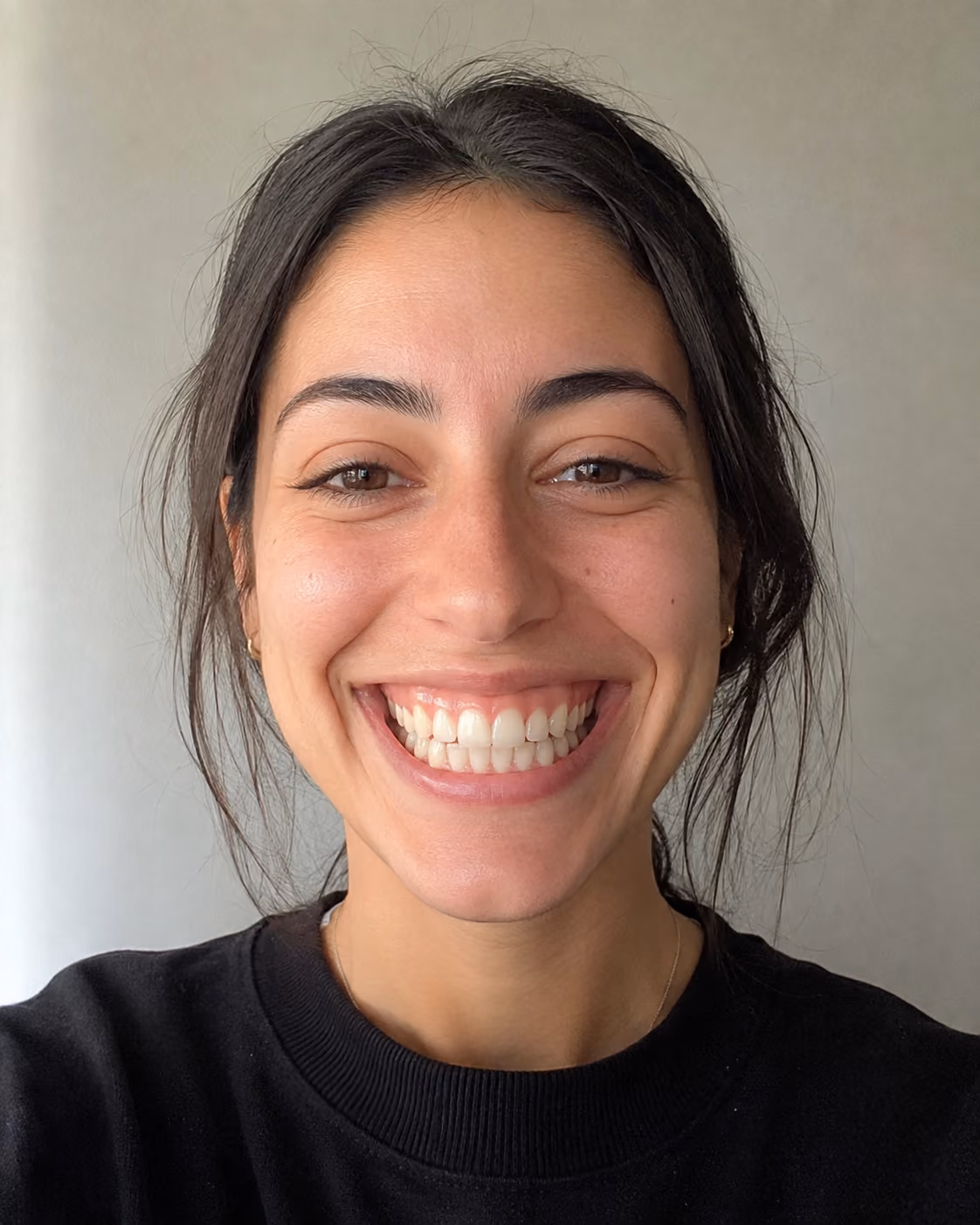 Example photo: full wide smile showing gum line and teeth