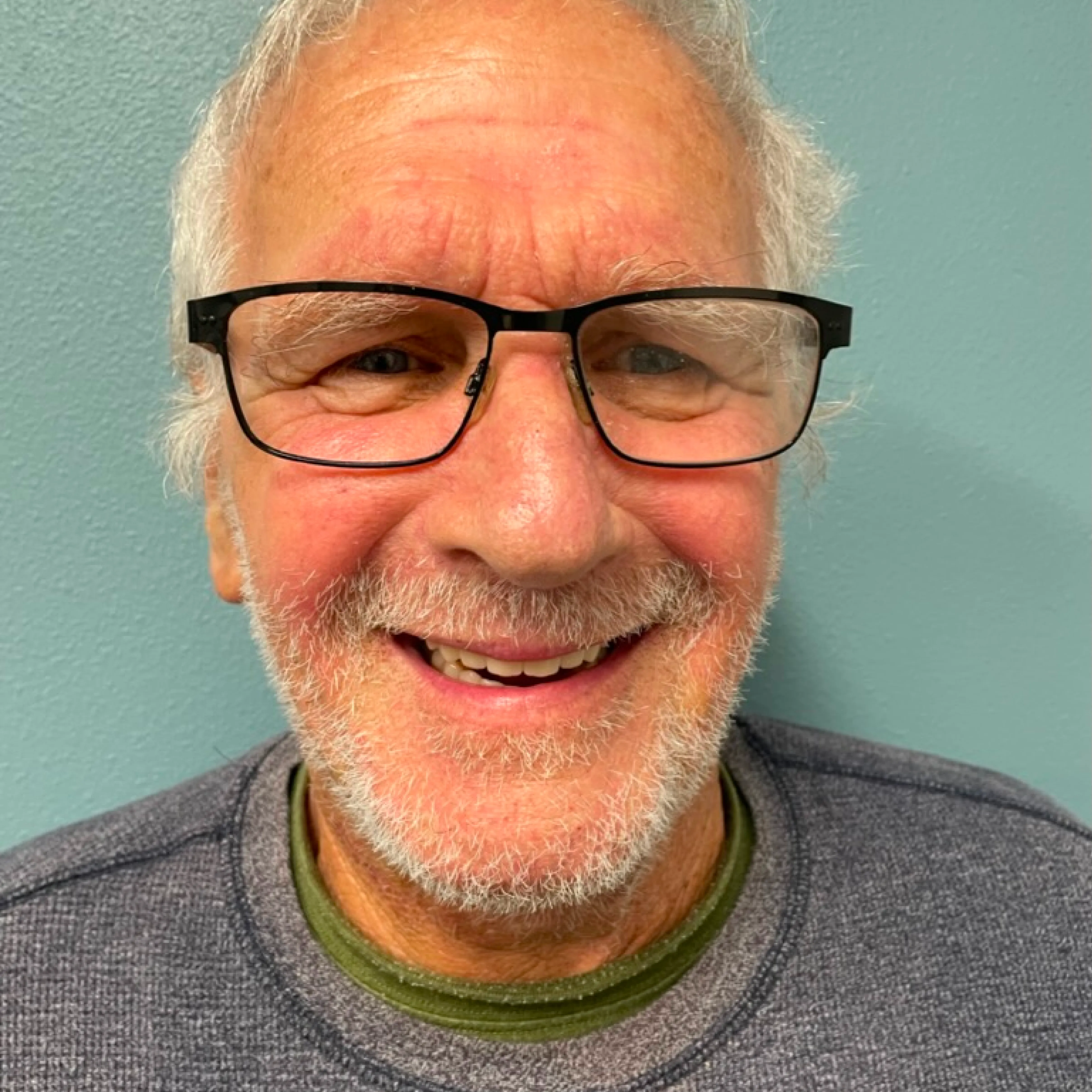 After: upper arch restored with tilted posterior implants, no bone grafting required