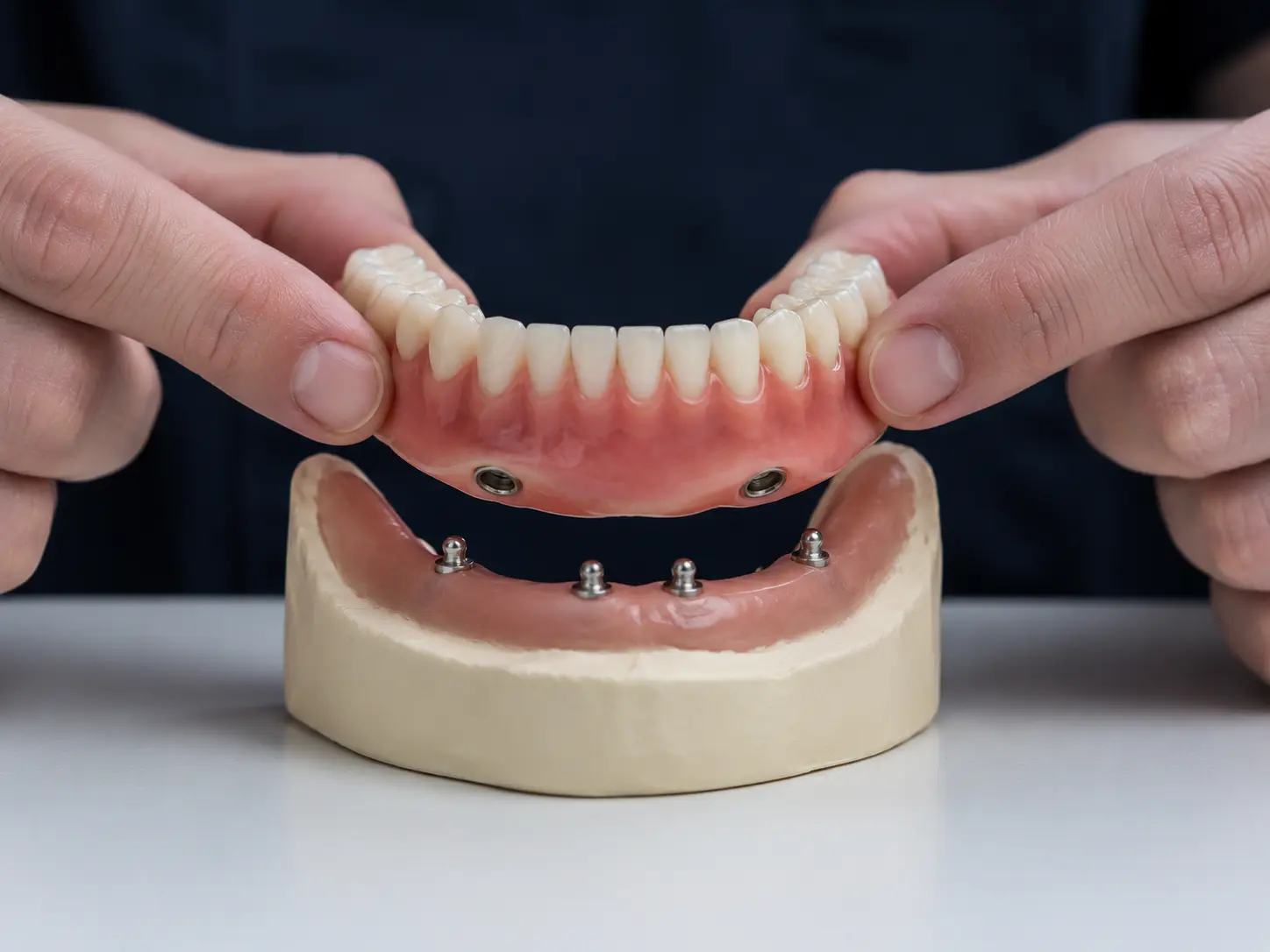 Implant-retained overdenture options for Federal Way patients