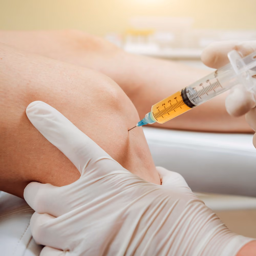 Een arts met handschoenen brengt een injectie met een spuit in iemands knie.