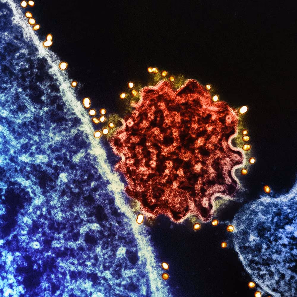 Microscopische afbeelding van een virusdeeltje in rood dat zich tussen twee blauwe cellen bevindt, met kleine gele virusdeeltjes aan de randen.