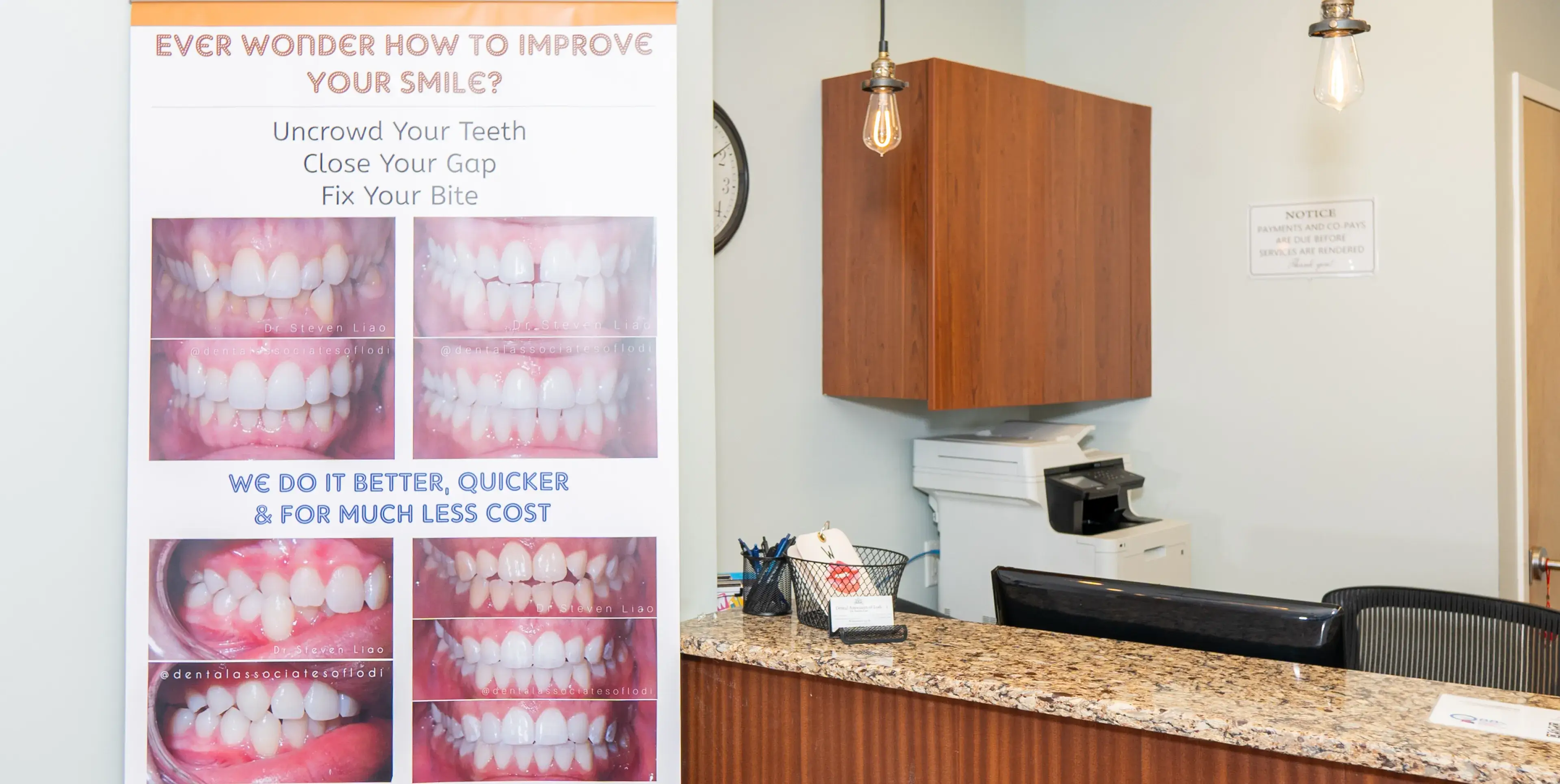 Dental office reception showing a counter with a basket of pens and a monitor, a wooden cabinet, printer, and a poster displaying before-and-after teeth alignment photos promoting smile improvement.