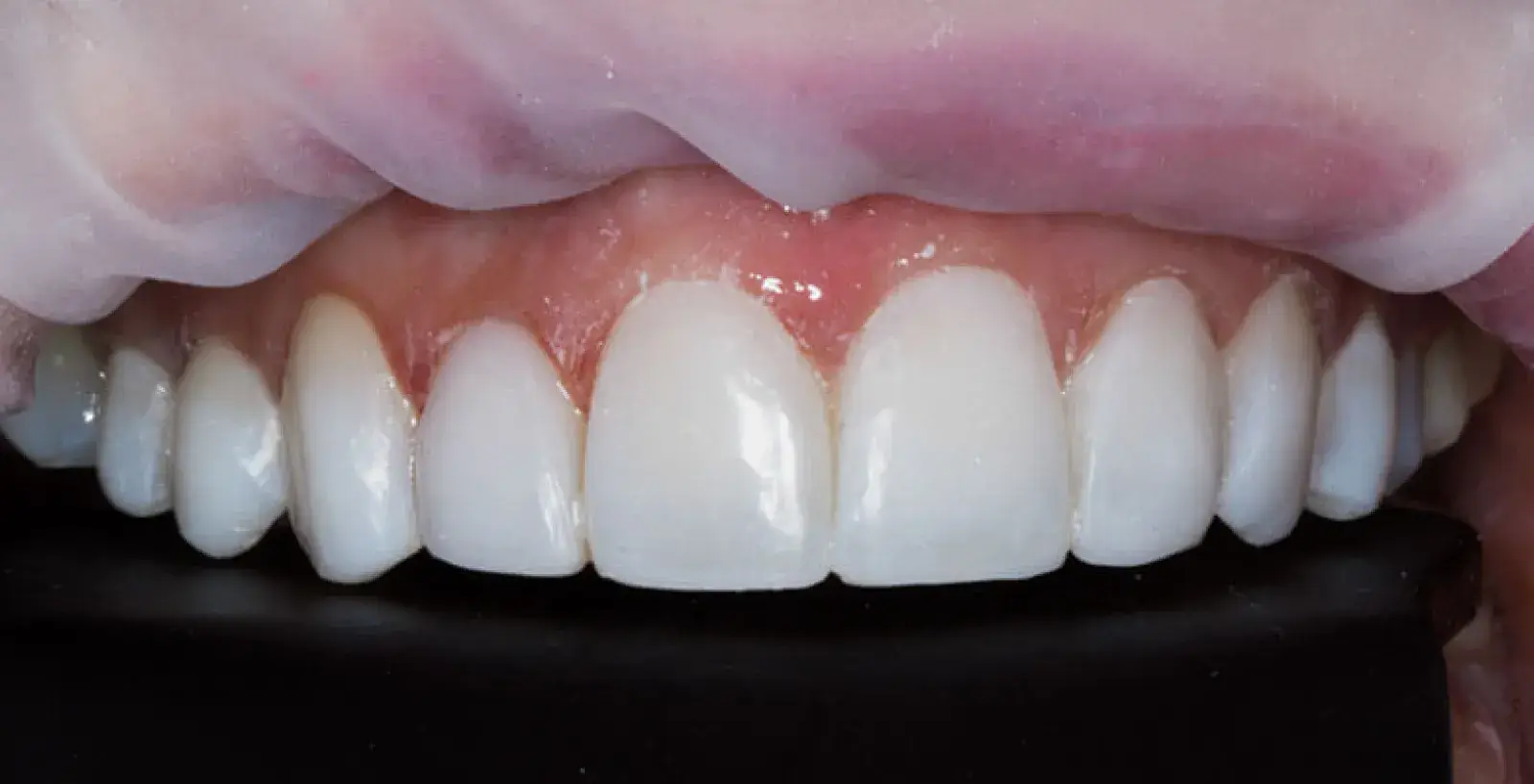 Close-up of a person showing a row of clean, white teeth.