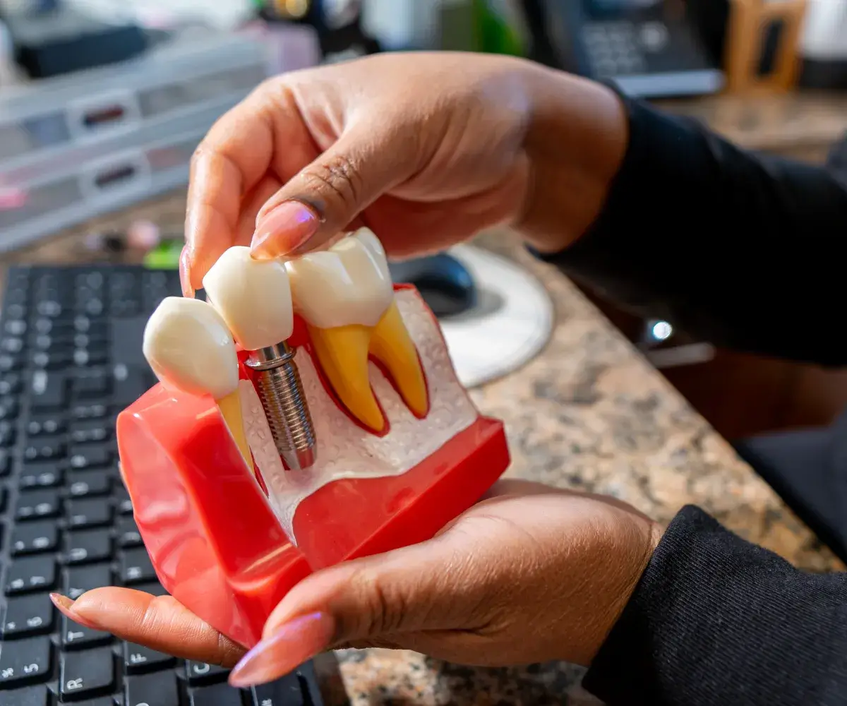 A person holds a dental model showing a dental implant next to natural teeth.