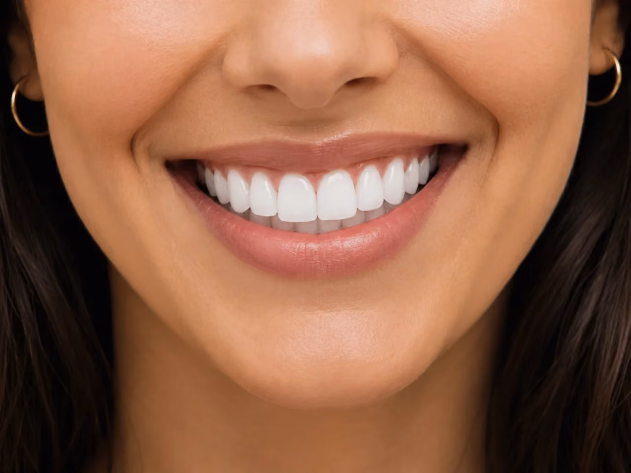 Close-up of a smiling woman showing white teeth and wearing gold hoop earrings.