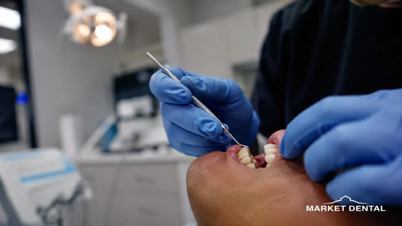 If You Floss Every Day and Still Bleed, What Can a Dental Exam Check