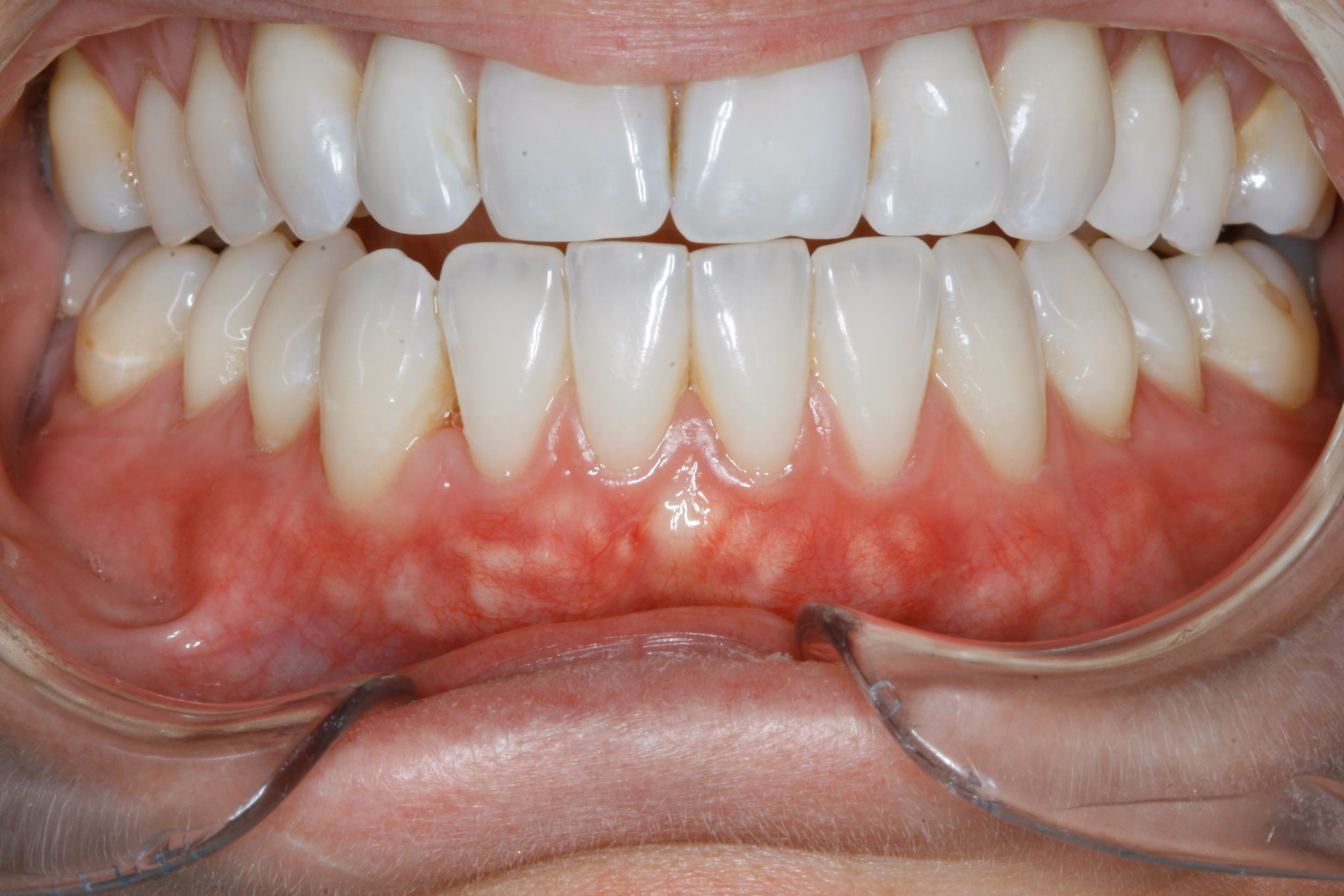 Before Image