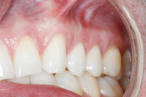 After Image