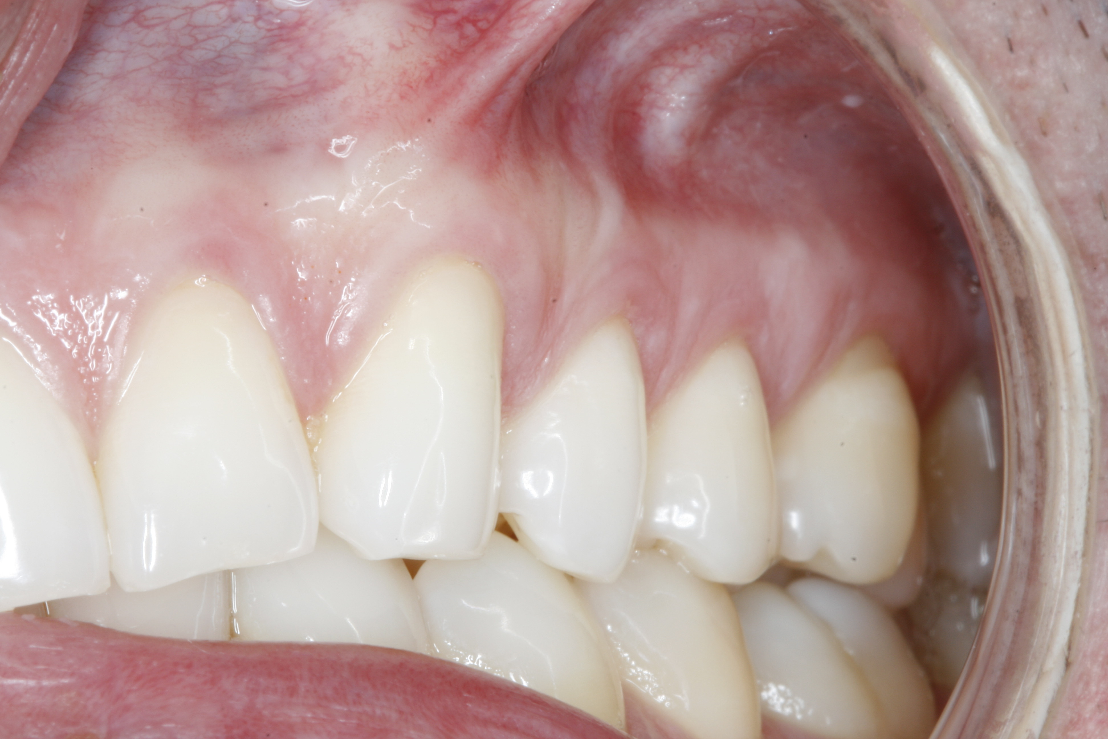 After Image