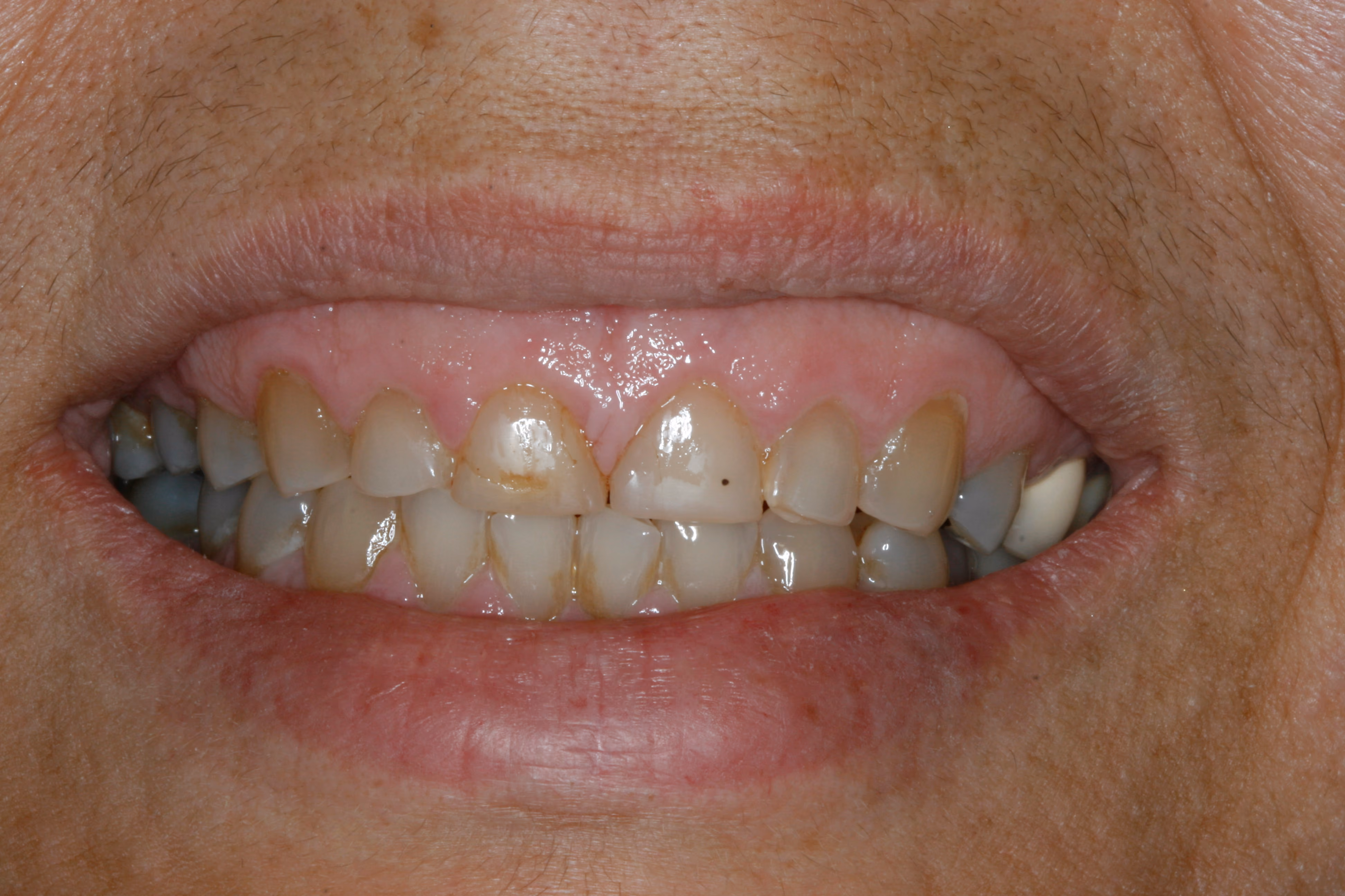 Before Image