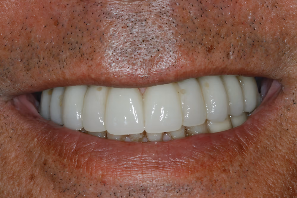 After Image