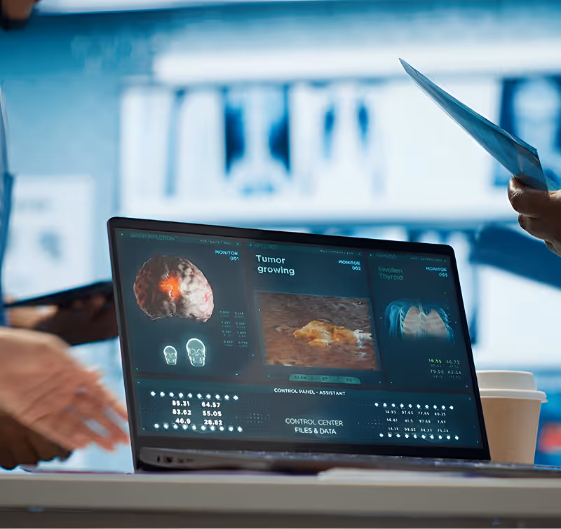 Laptop screen displaying medical scans