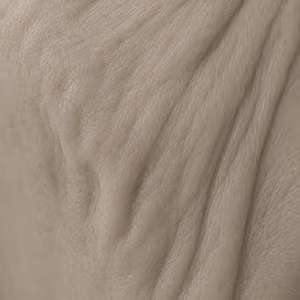 Close-up of skin showing mild laxity and loss of firmness