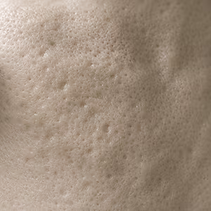 Close-up of skin showing uneven texture and visible pores