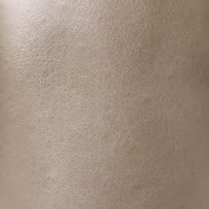 Close-up of skin showing dullness and loss of radiance