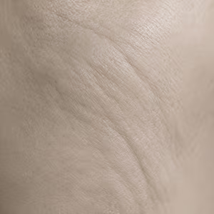 Close-up of skin showing fine lines and wrinkles