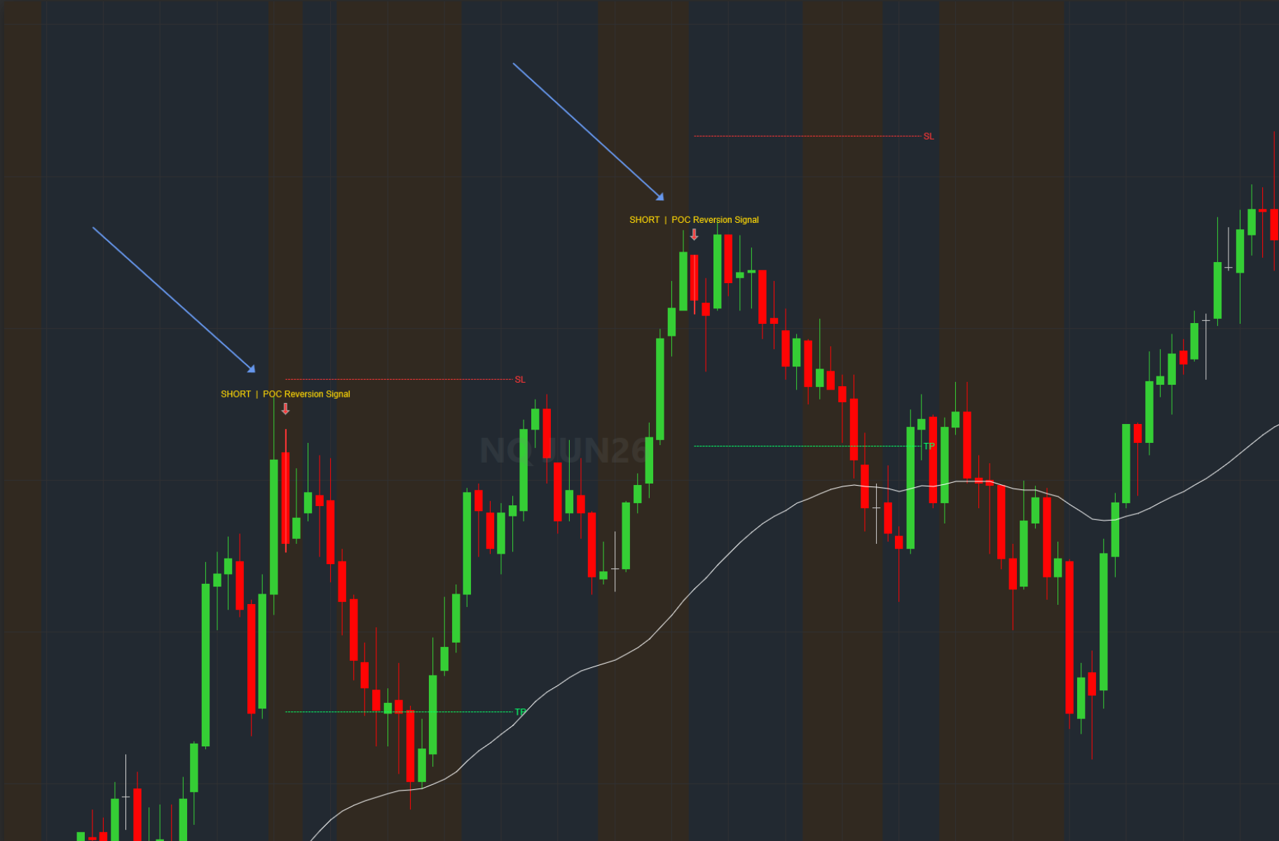 Scalp Bands