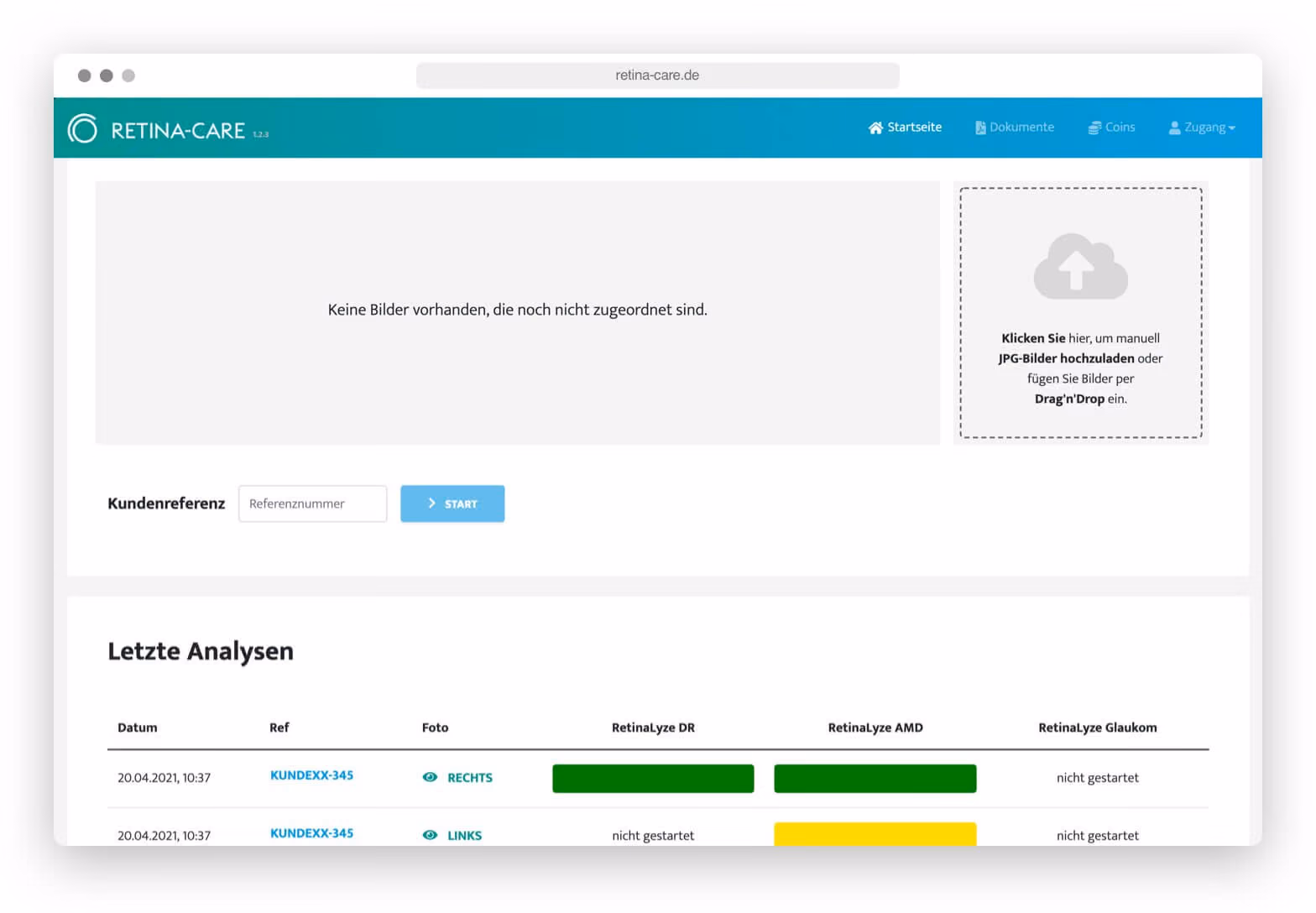 Webseite Retina-Care mit Kundenreferenz, Upload-Bereich für JPG-Bilder und letzte Analyseergebnisse.