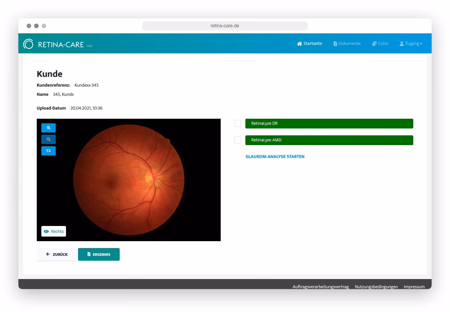 Bildschirm mit Retina-Care-Webseite zeigt Netzhaut eines rechten Auges und Analyseoptionen.