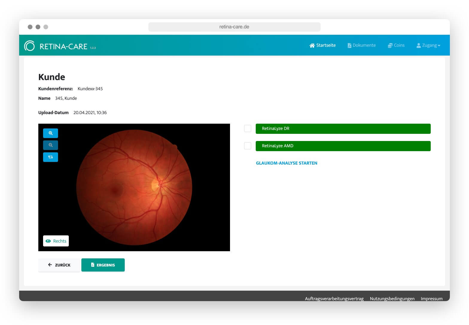 Bildschirm mit Retina-Care-Webseite zeigt Netzhaut eines rechten Auges und Analyseoptionen.