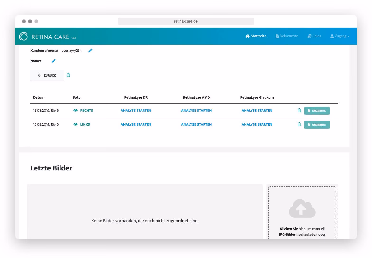 Webseite von Retina-Care zeigt Patientendaten mit Datum, Fotos und Analyseoptionen für Augenuntersuchungen.