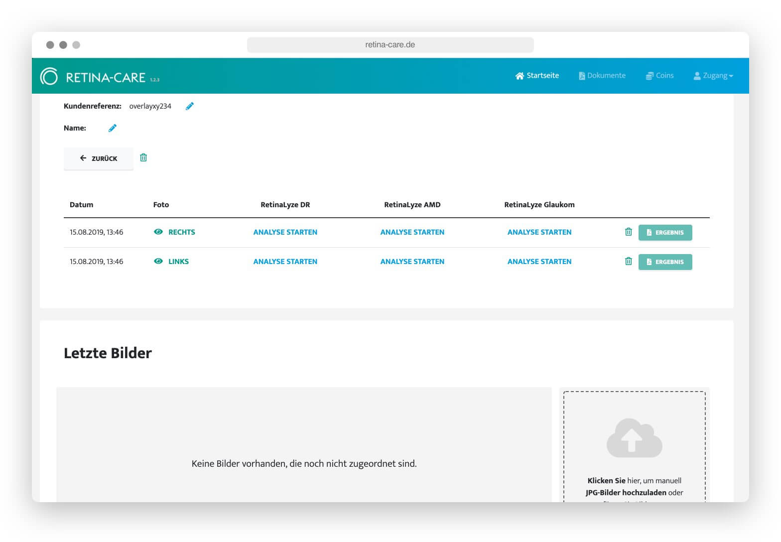 Webseite von Retina-Care zeigt Patientendaten mit Datum, Fotos und Analyseoptionen für Augenuntersuchungen.