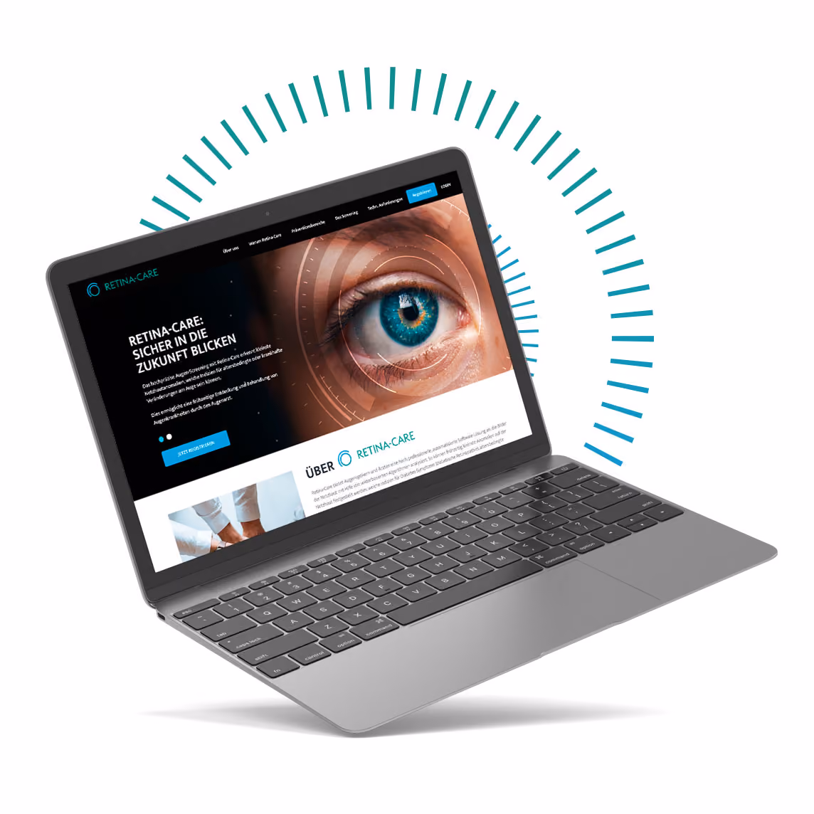 Laptop mit Retina-Care-Webseite und einem Bild eines Auges, umgeben von blauen Linien.