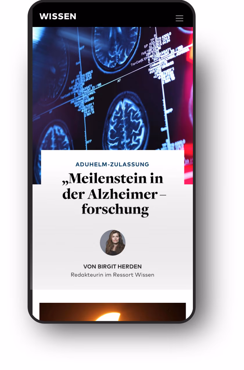 Smartphone zeigt Artikel über Alzheimerforschung mit Hirn-Scans im Hintergrund.