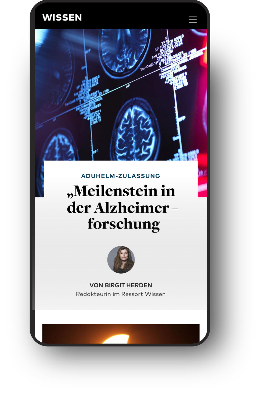 Smartphone zeigt Artikel über Alzheimerforschung mit Hirn-Scans im Hintergrund.